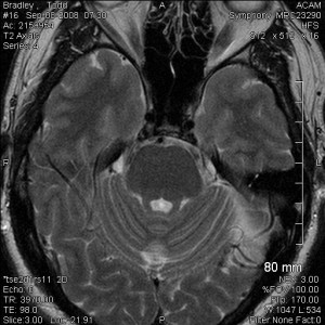 a slice of Todd's brain